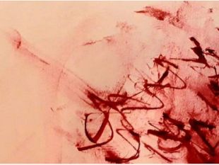 troppo-amore-la-medicalizzazione-fascista-di-passioni-e-sentimenti