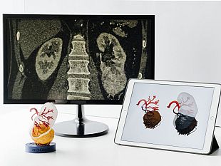 chirurgia-renale-del-futuro-urologi-parlano-di-robotica-a-firenze