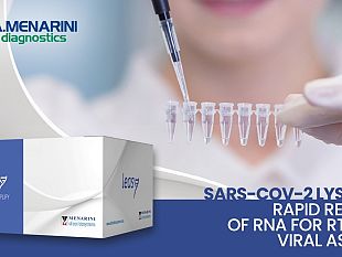 covid-19-da-menarini-un-nuovo-reagente-made-in-italy