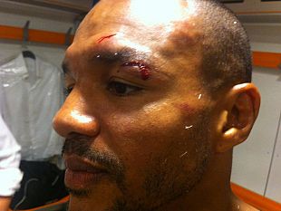 b207142353-leonard-bundu-resta-campione-con-i-soliti-problemi-ancora-una-ferita