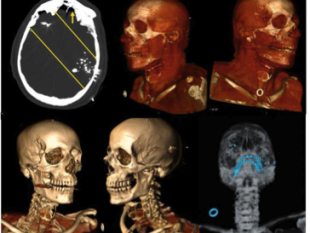 autopsia-virtuale-a-careggiil-primo-laboratorio-in-italia