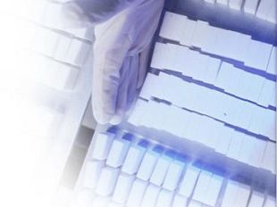 b207141631-barbabietola-da-zucchero-risorse-aggiuntive-per-la-riconversione