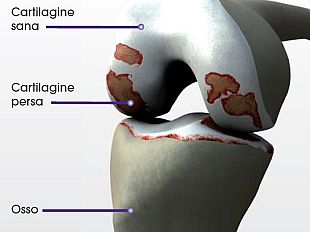 b304021443-ginocchio-ed-artrosi-i-migliori-chirurghi-d-europa-si-ritrovano-a-firenze