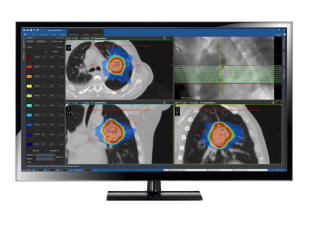 ecomedica-allavanguardia-nazionale-nella-radioterapia