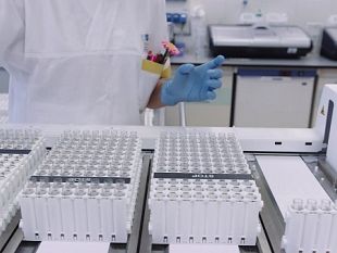 covid-contagi-reali-oltre-50mila-parla-crisanti