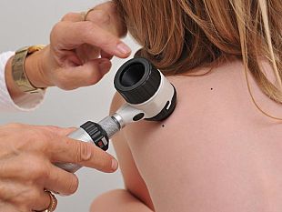 tumore-della-pelle-in-aumento-una-emergenza-sanitaria