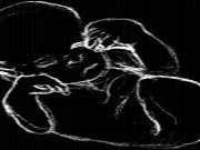 a406041749-nata-con-una-rarissima-malformazione-la-fusione-degli-arti-inferiori-br-e-all-ospedale-meyer-di-firenze