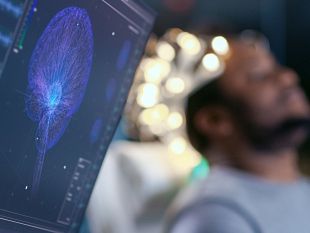 lotta-contro-il-glioblastoma-toscana-in-prima-linea-nella-ricerca