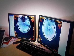 b211091448-neurogenetica-al-meyer-firmato-un-importante-accordo-sulle-malattie-rare