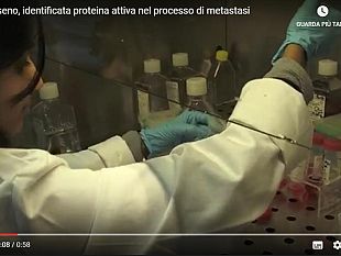 cancro-al-seno-una-proteina-utile-al-cuore-e-coinvolta-nel-tumore