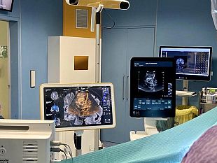 lotta-ai-tumori-cerebrali-allifca-metodo-innovativo-accessibile-a-tutti