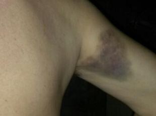 violenza-sulle-donne-1500-casi-in-codice-rosa-nel-primo-semestre-2014
