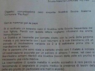 scabbia-nuovo-caso-in-una-scuola-di-firenze