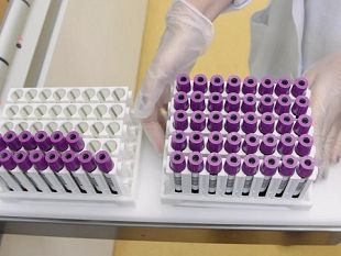 plasma-terapia-per-coronavirus