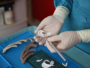 meyer-orecchio-ricostruito-a-13enne-grazie-alla-stampa-3d