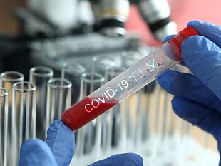 coronavirus-alto-tasso-di-nuovi-positivi-in-toscana-179