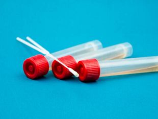 coronavirus-281-positivi-in-toscana