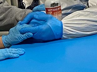 ricoveri-pazienti-covid-le-nuove-linee-di-indirizzo