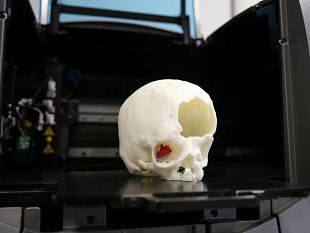al-meyer-eseguito-intervento-innovativo-e-non-invasivo-grazie-alla-stampa-3d