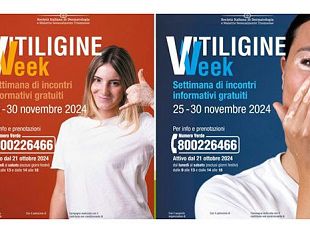 la-vitiligine-week-in-toscana-incontri-gratuiti-con-i-dermatologi