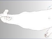 a406071844-meyer-careggi-e-asl-10-sinergia-tra-istituzioni-sanitarie-fiorentine-per-affrontare-un-rarissimo-caso-di-sirenomelia