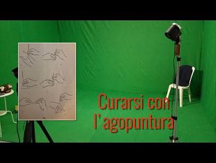 curarsi-con-lagopuntura