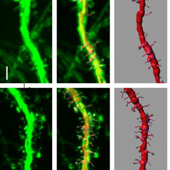 /images/5/5/55-filamenti-neuroni.jpg