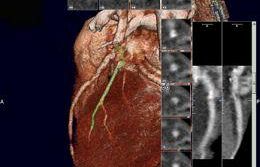 per-il-tuo-cuore-una-delle-piu-importanti-iniziative-di-prevenzione