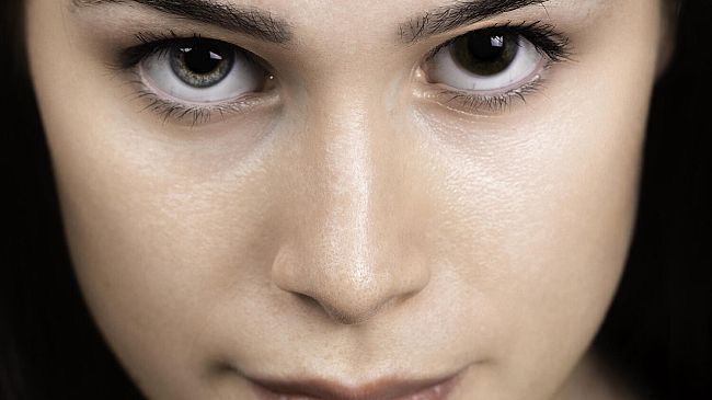 Occhi di colore diverso, perché?