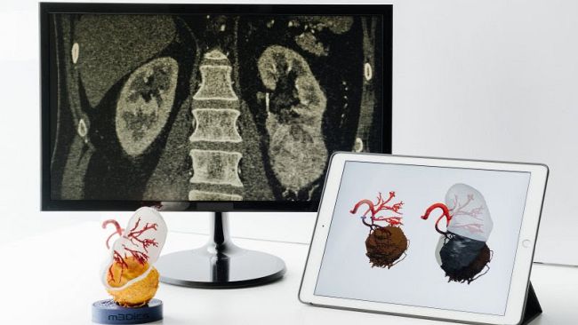 Chirurgia renale del futuro: Urologi parlano di robotica a Firenze