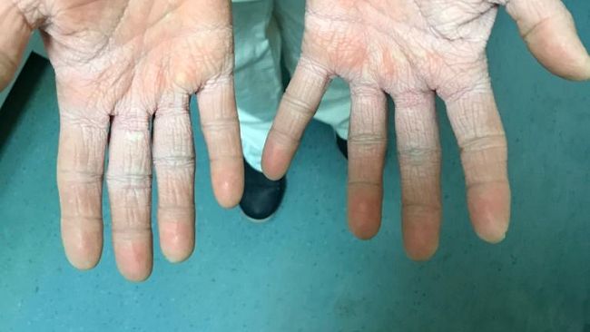 Covid Toscana: 1.302 nuovi casi, 20 decessi, terapie intensive stabili