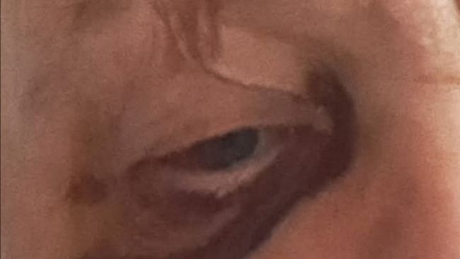 Tassista aggredito e picchiato in viale Guidoni 