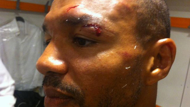 Leonard Bundu resta campione con i soliti problemi: ancora una ferita