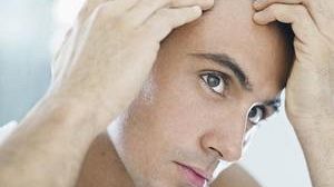 Riacquistare una chioma folta grazie all'autotrapianto di capelli