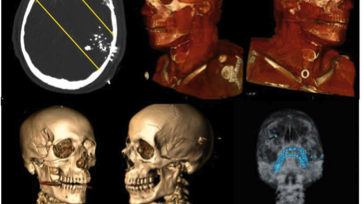 Autopsia virtuale, a Careggi il primo laboratorio in Italia
