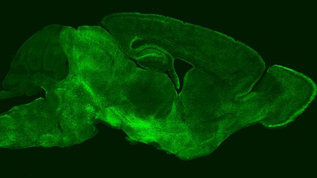 Ricercatori pisani “fotografano” per la prima volta come si sviluppa il cervello