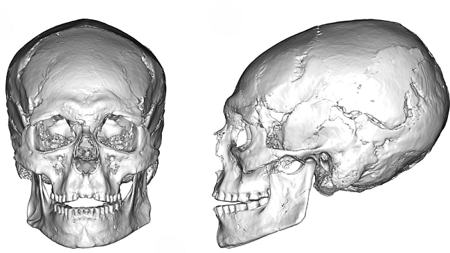Modificazione intenzionale del corpo, a Firenze la più antica evidenza