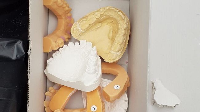 Abbandona calchi e rifiuti di studio, denunciata dentista