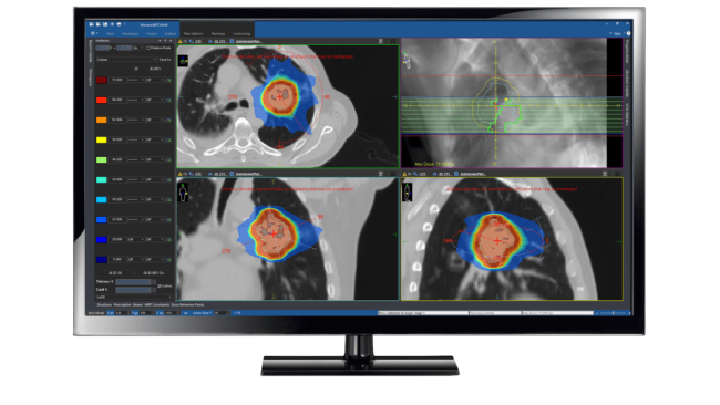 Ecomedica all'avanguardia nazionale nella radioterapia