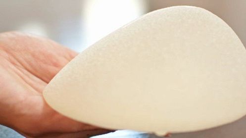 Protesi al seno, da Allergan a Johnson & Johnson: in Toscana tracciabilità pazienti - dispositivi