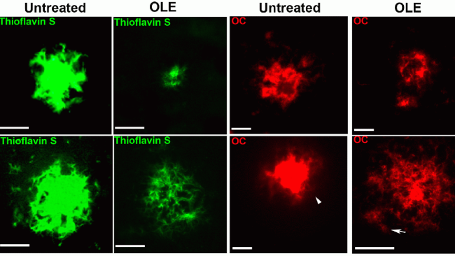 Olio extravergine di oliva arma anti invecchiamento