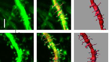 Senza la molecola della felicità scatta la sindrome maniacale