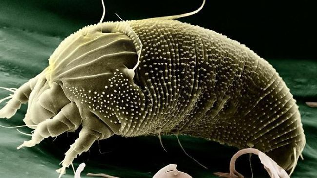 Curare la scabbia a Firenze: difficoltà diagnostica, costi economici e sociali