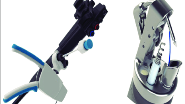 Dissezione sottomucosa, tolti due tumori a un paziente