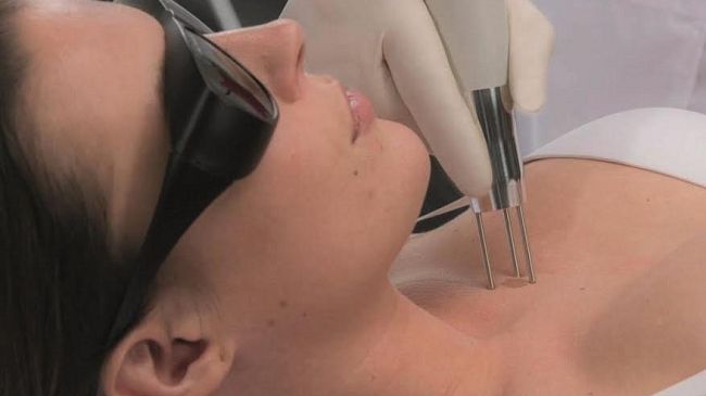 Inestetismi della pelle: le lesioni pigmentate creano sofferenza psicologica 