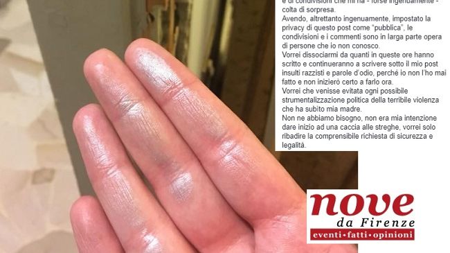 Rapina a Firenze e sfogo su Facebook: giovane derubata si dissocia dall'odio in rete
