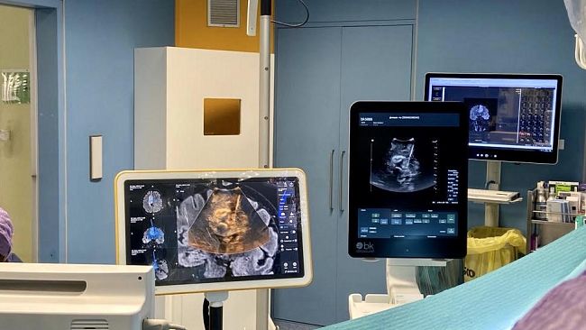 Lotta ai tumori cerebrali, a Firenze metodo innovativo accessibile a tutti