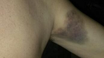 Violenza sulle donne: 1.500 casi in Codice rosa nel primo semestre 2014