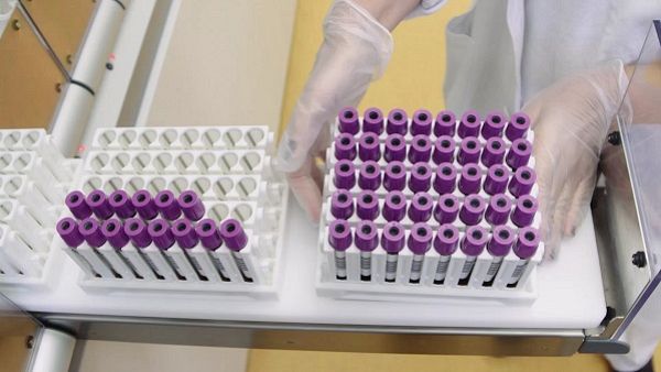 Plasma terapia per Coronavirus: corsa per donare in Toscana