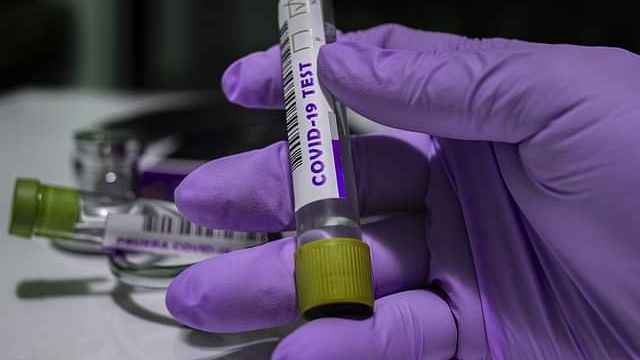 Covid Toscana 20 gennaio: 443 positivi, rapporto coi tamponi 8,2%